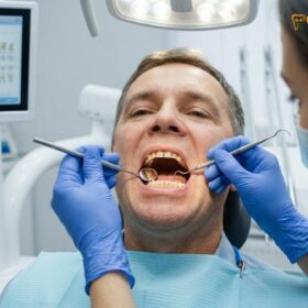 Dental Reconstruction Before and After: Clinical Guide | HCMC Dental