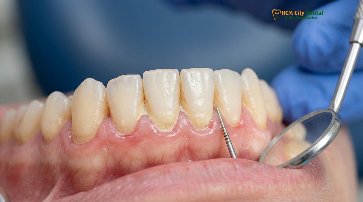 Visual illustration of dental avoidance