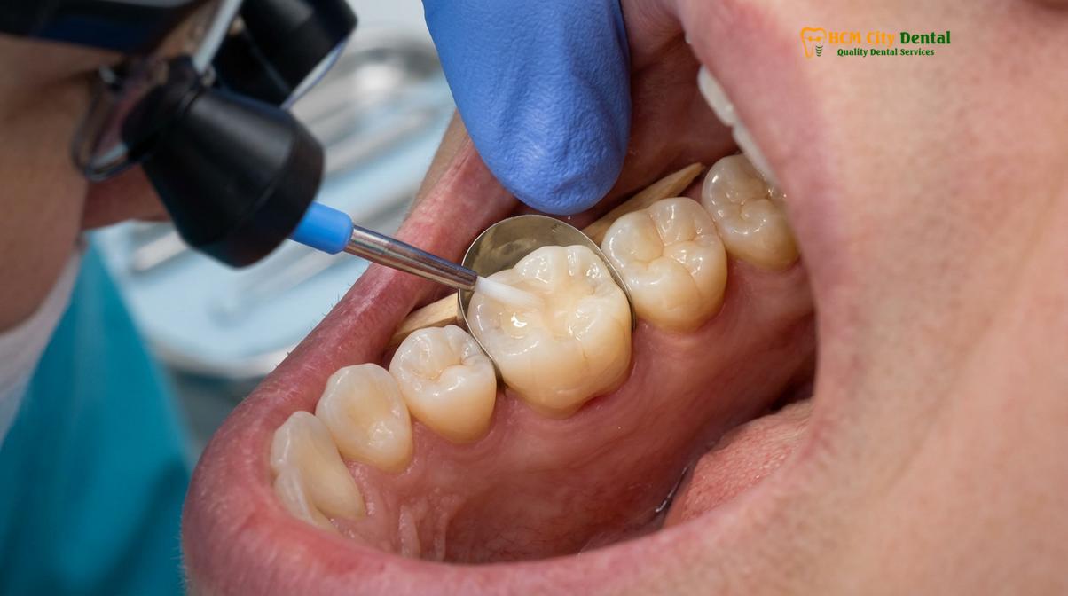 Visual description of Dental Care Package Cleaning Whitening Filling Combo