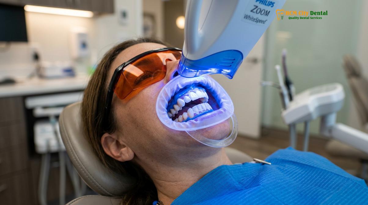 Visual illustration of Dental Cleaning Before Whitening Veneers