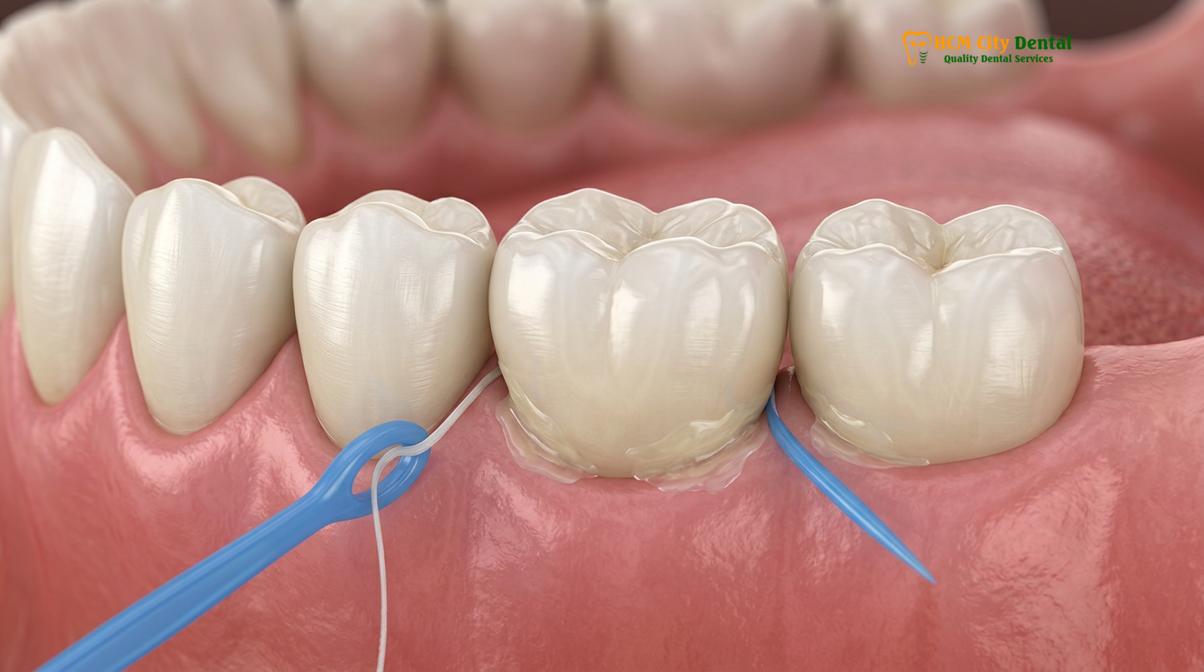 Visual description of dental cleaning implants crowns bridges