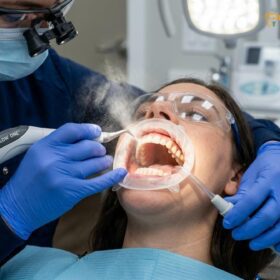 Jet Dental: Clinical Air Polishing Guide | HCMC Dental