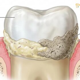 Dental Cleaning Scaling Expat Package | HCMC Dental