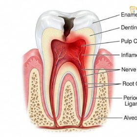Dental Emergency Traveling Vietnam: Clinical Guide | HCMC Dental
