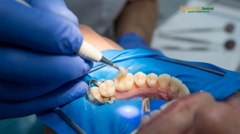Dental Filling Cost Vietnam vs UK & Singapore | HCMC Dental