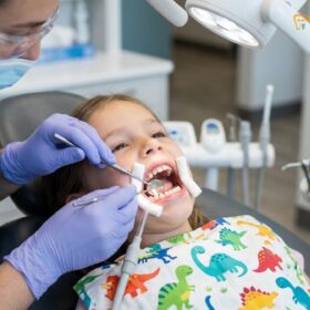 Composite vs Glass Ionomer Fillings for Kids: Clinical Guide