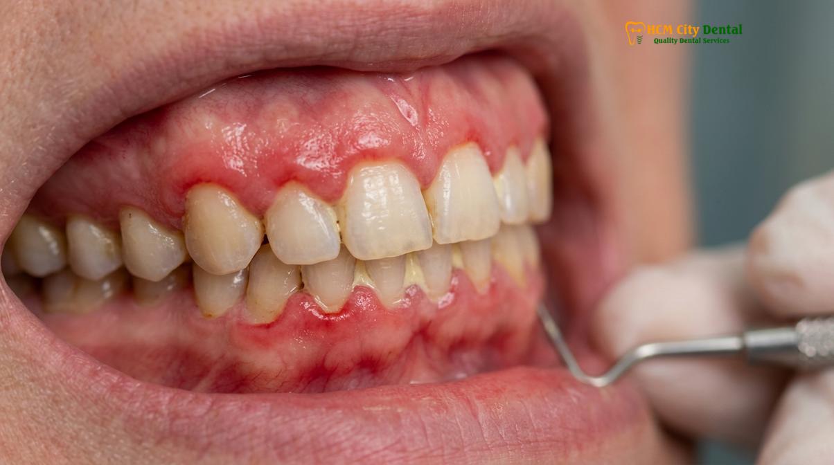 Visual description of dental nerve pain vs gum pain