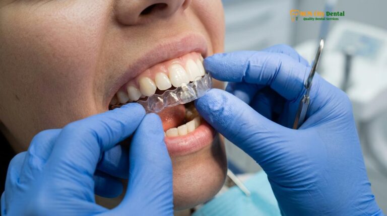 Dental Tourism Vietnam: Orthodontic Retention | HCMC Dental