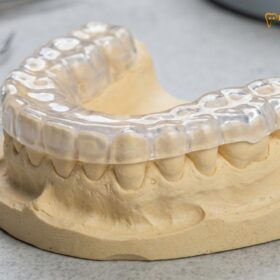 Dual Laminate Night Guard: Clinical Guide | HCMC Dental