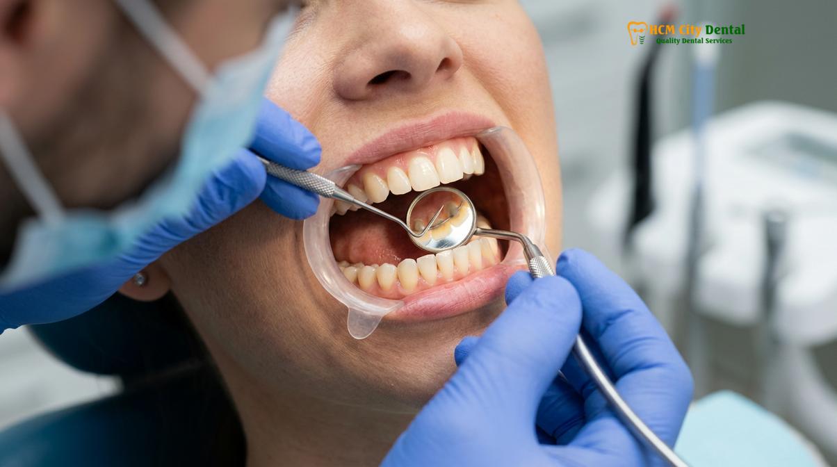 Visual illustration of English speaking dentist retainer replacement