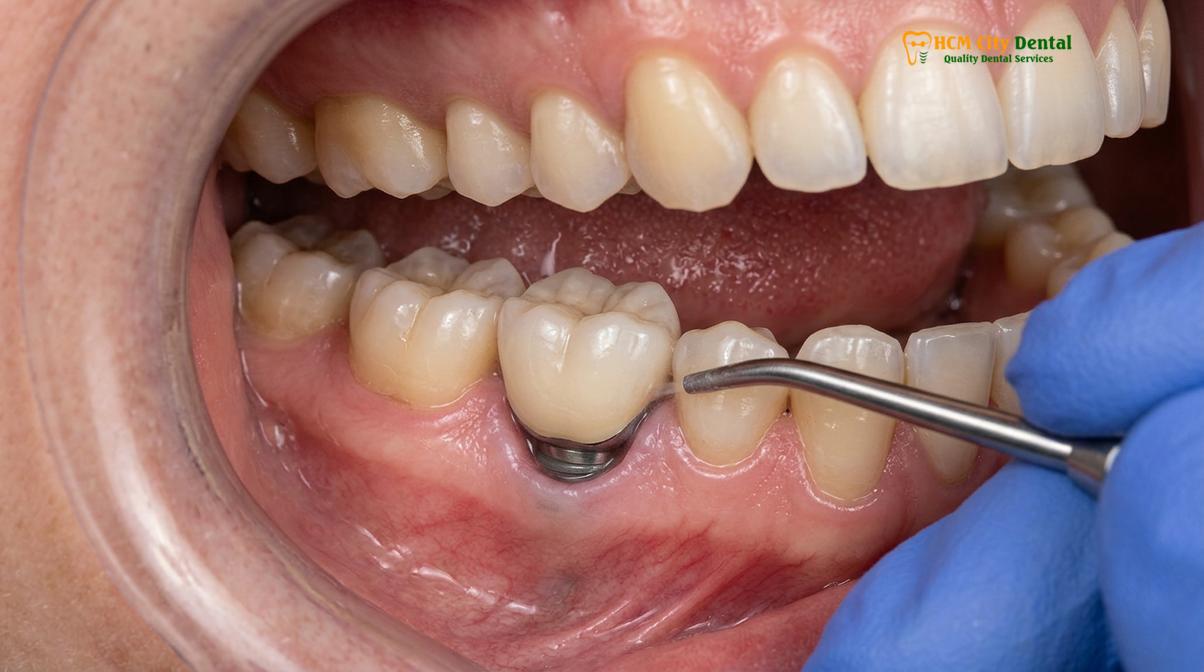 Visual description of erythritol powder teeth cleaning