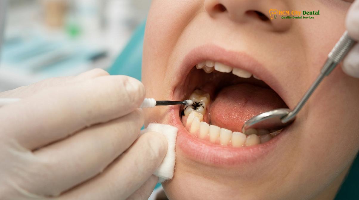 Visual description of prepare child first dental visit