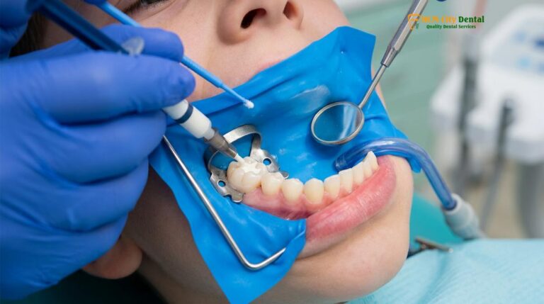 Fissure Sealant vs Fluoride Varnish: Clinical Pediatric Guide