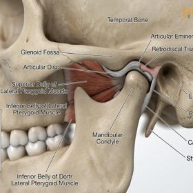 Full Mouth Reconstruction TMJ Vietnam: Clinical Guide | HCMC Dental