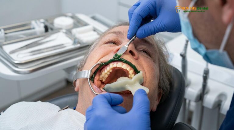 Border Molding Dentures: Clinical Guide | HCMC Dental