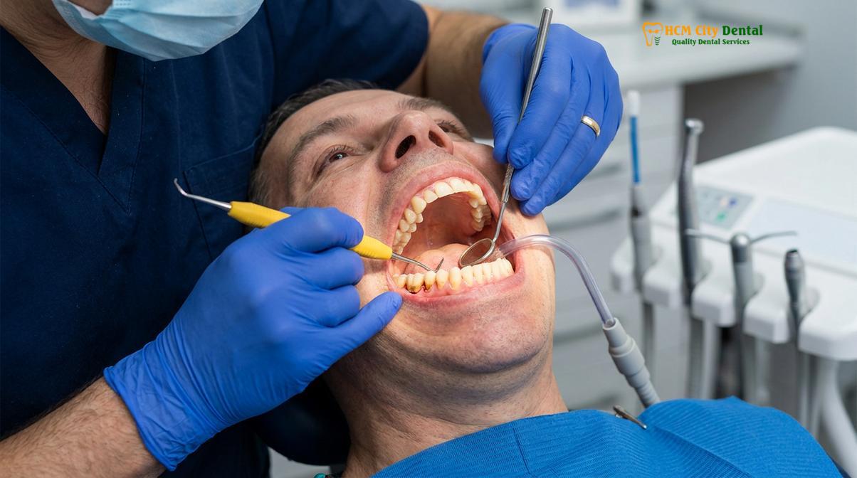 Visual description of gingivitis vs periodontitis