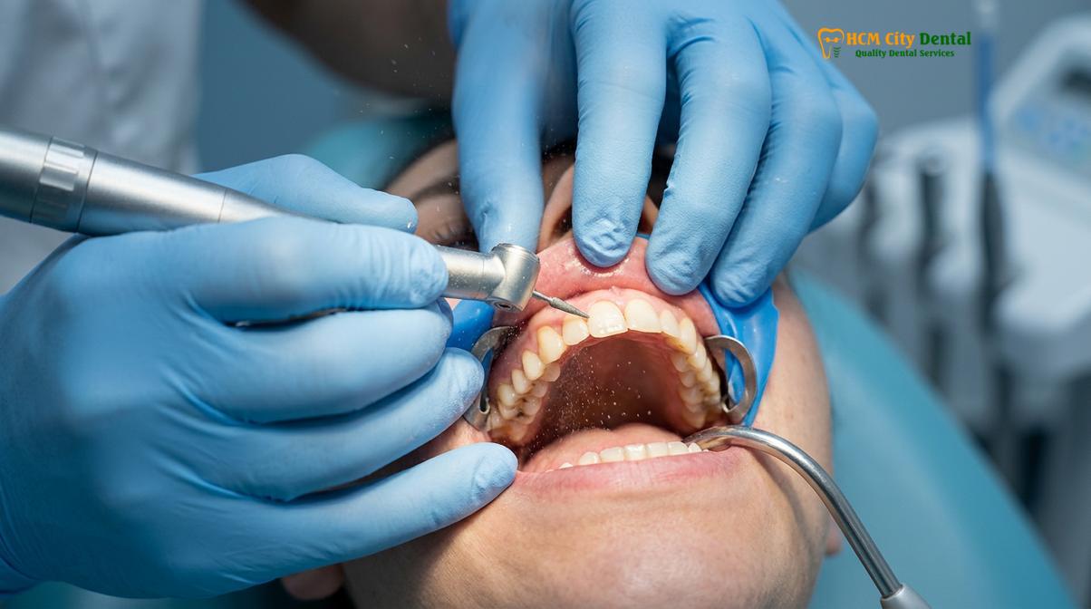Clinical photography related to good dental care