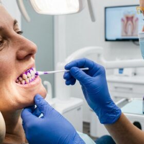 Guided Biofilm Therapy EMS: Advanced Clinical Dental Cleaning