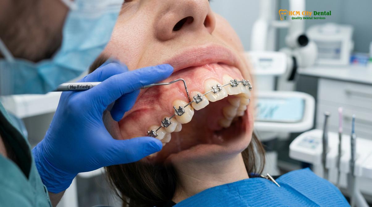 Visual description of gum disease braces