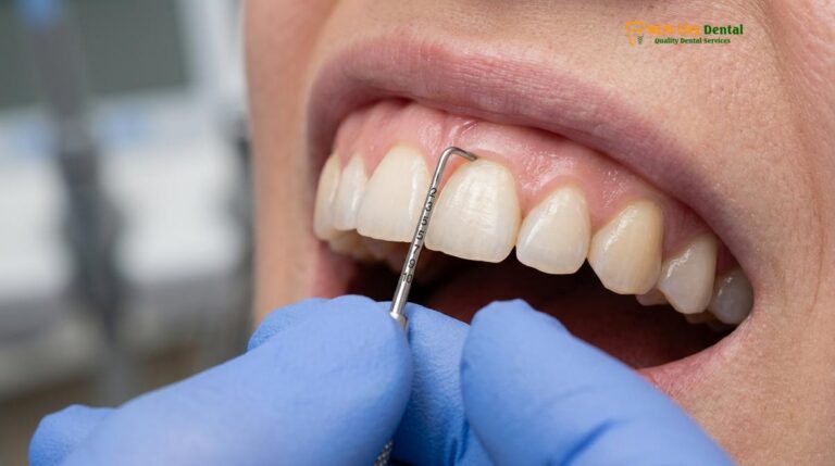 Gummy Smile Correction Methods: Clinical Guide & Treatment Options