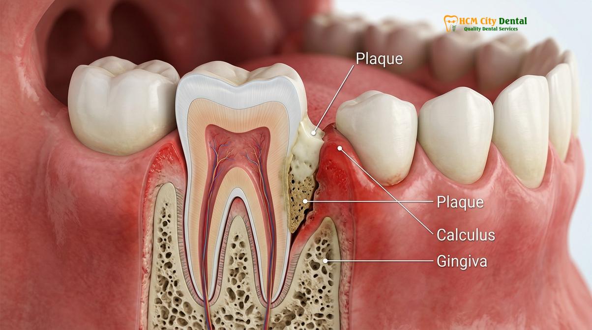 Clinical photography related to halitosis