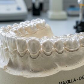Hard vs Soft Night Guard: Clinical Differences | HCMC Dental