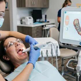 Hidden Costs of Dental Crowns in Vietnam: A Clinical Pricing Guide