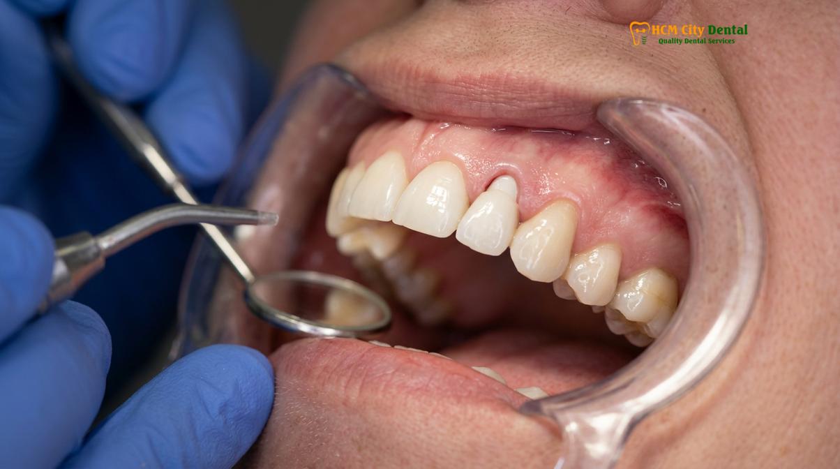 Visual illustration of holistic dental tourism Vietnam
