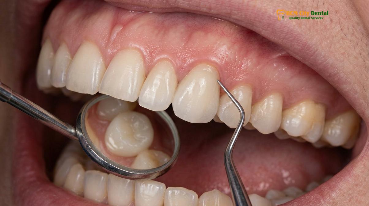 Clinical photography related to holistic dentist Vietnam