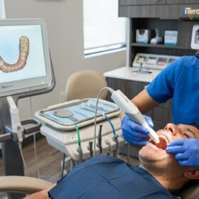 How Long Do Porcelain Inlays Last? Clinical Lifespan & Care Guide