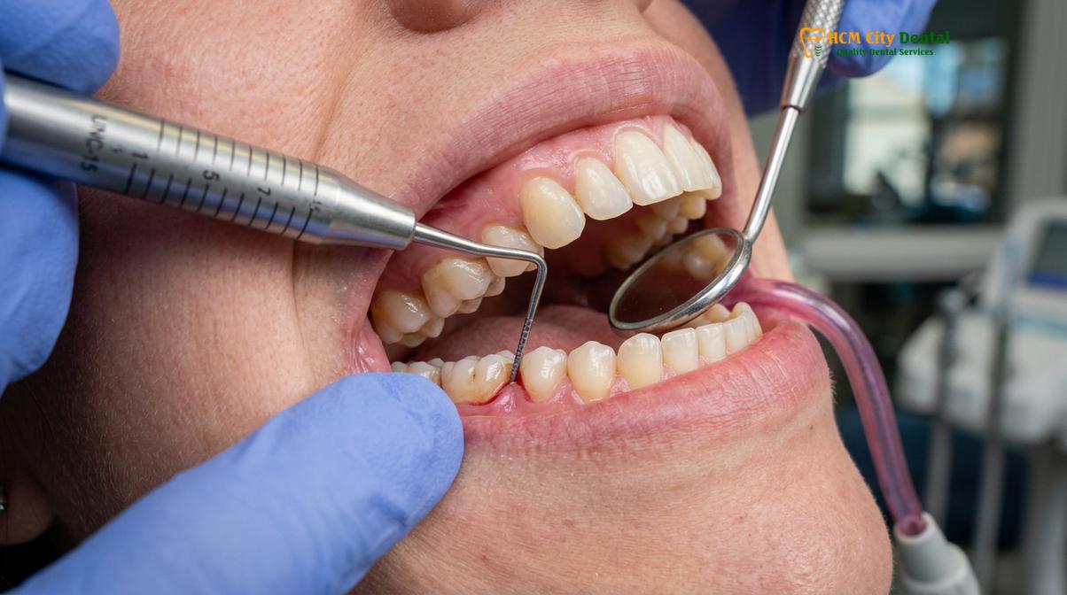 Visual description of how long does dental cleaning take
