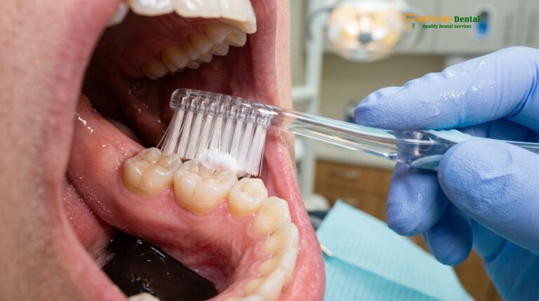 How Long Should You Brush Your Teeth? Clinical Guide | HCMC Dental