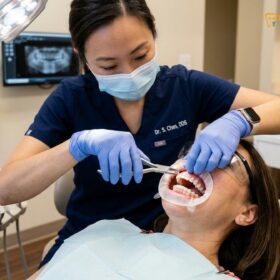How Much Do Braces Cost? Clinical Price Guide | HCMC Dental