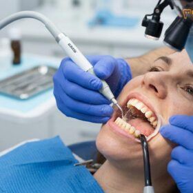 How Often Dental Cleaning Expat Vietnam | HCMC Dental