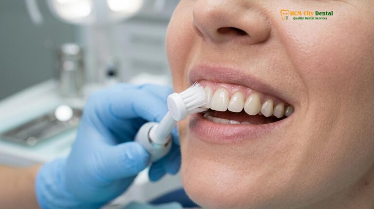 How to Clean Veneers: Clinical Guide to Maintenance & Longevity