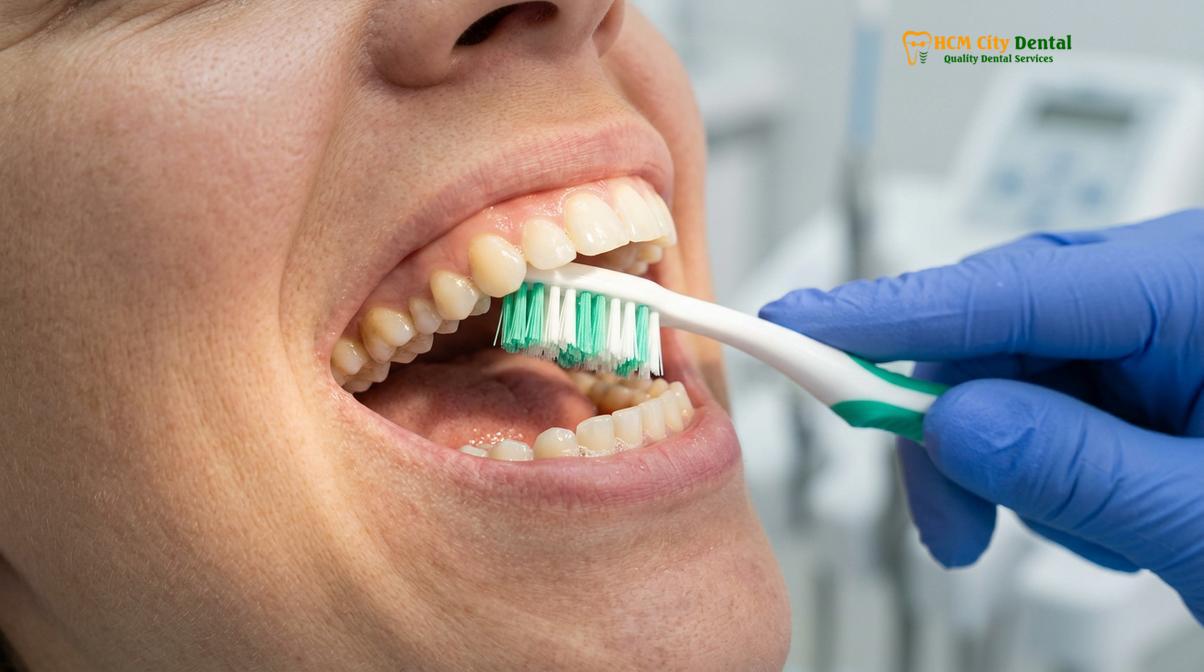 Clinical photography related to how to prevent gum disease