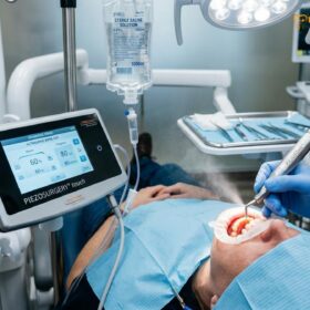 Piezotome Dental Implant Surgery: Clinical Guide | HCMC Dental