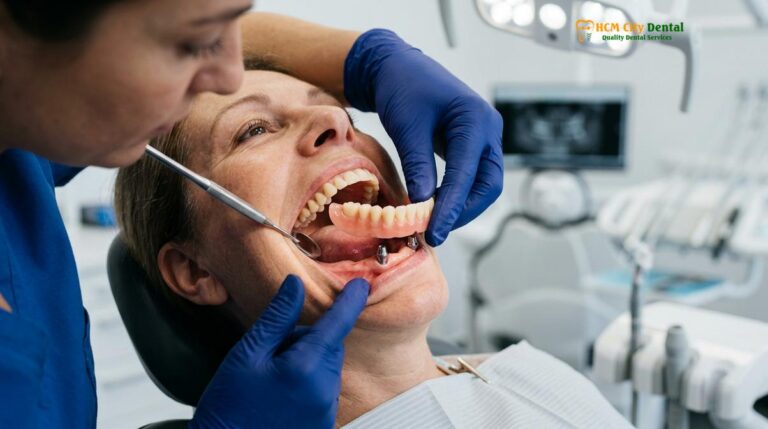 Implant Supported Overdenture HCMC | Snap-On Teeth Guide