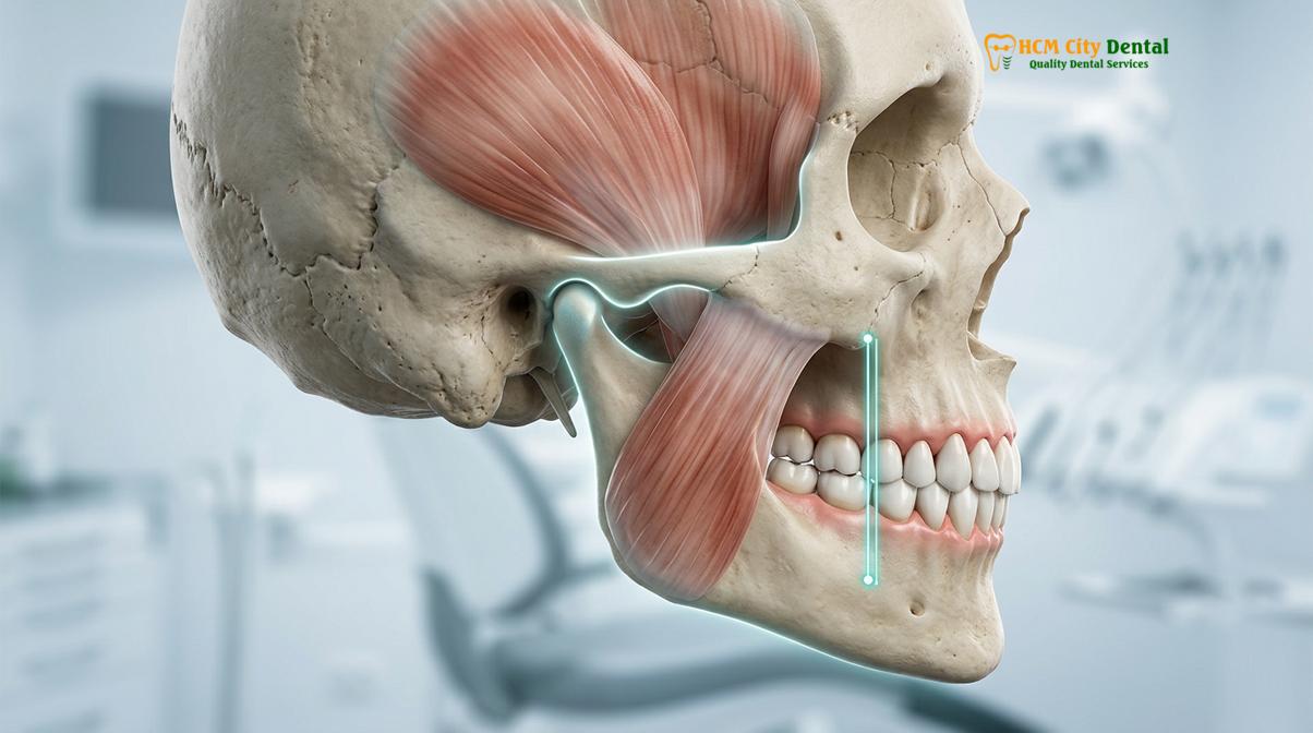 Clinical photography related to cad cam full arch restoration