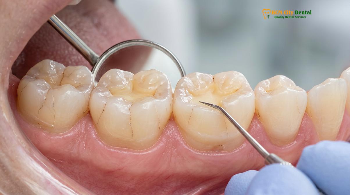 Visual illustration of jaw pain in morning bruxism