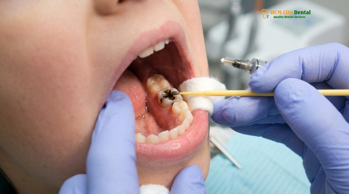 Clinical photography related to kids dentist thao dien