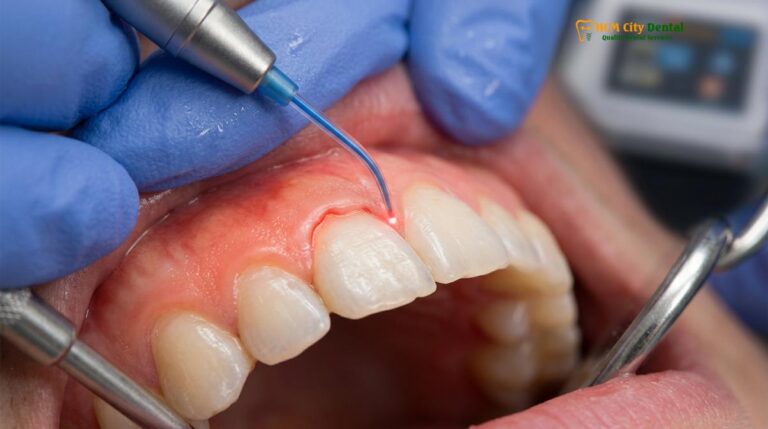 Laser Gingivectomy Saigon: Clinical Guide to Sutureless Gum Contouring