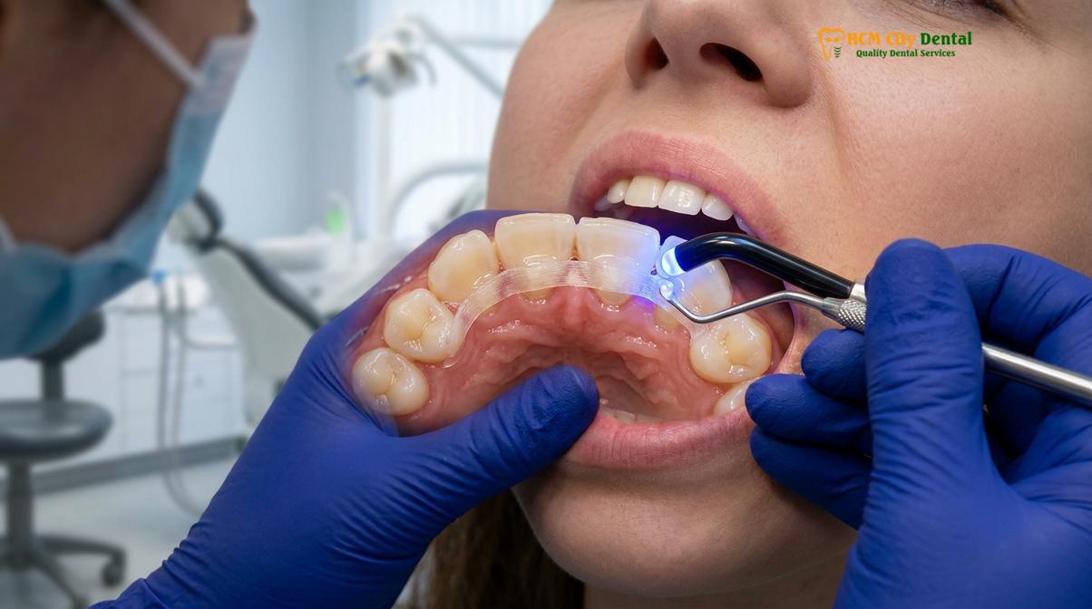 Visual description of loose tooth adult emergency