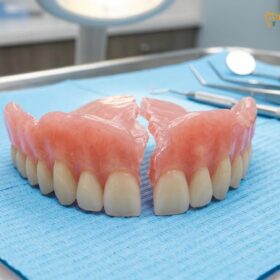 Lost Denture Abroad in Vietnam: Emergency Care | HCMC Dental