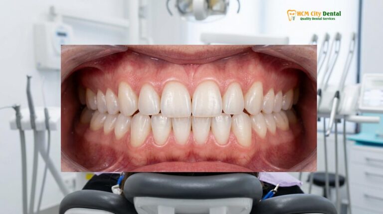 Lost My Retainer: What to Do, Immediate Steps & Replacement Guide