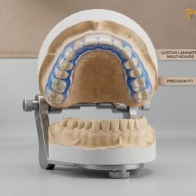 Custom Mouthguard Boxing & Muay Thai Vietnam | HCMC Dental