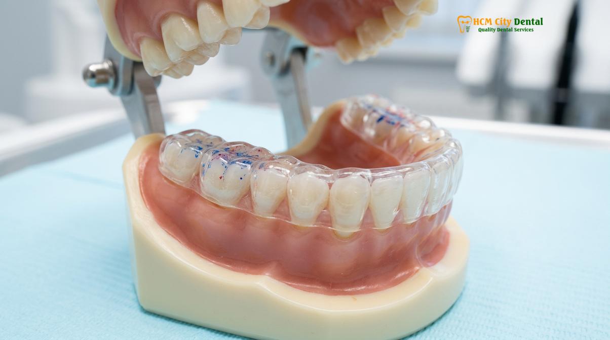 Visual description of neuromuscular dentistry full mouth