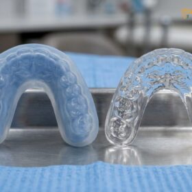 Night Guard vs Occlusal Splint: Clinical Differences | HCMC Dental