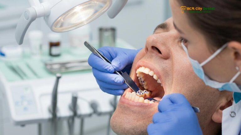 Bite Adjustment for TMJ Vietnam: Clinical Guide | HCMC Dental