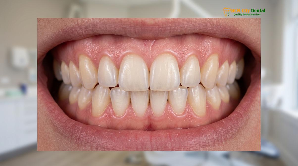 Clinical photography related to oil pulling oral health